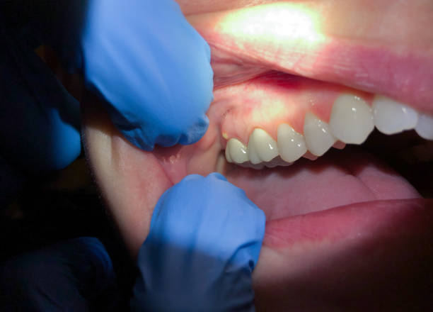 Best Pediatric Emergency Dentist in Martinsburg, WV