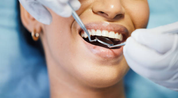 Best Emergency Wisdom Teeth Removal in Martinsburg, WV