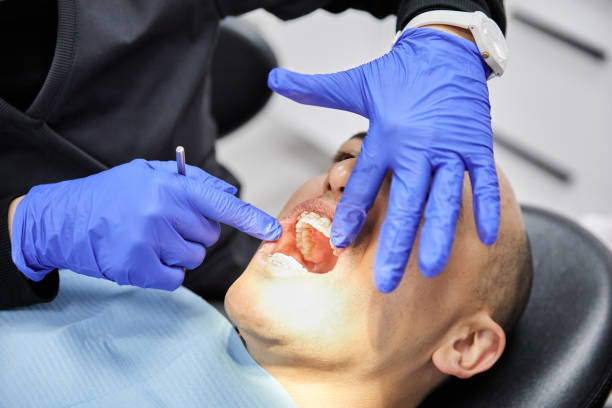 Best Emergency Root Canal Treatment in Martinsburg, WV