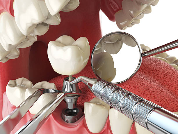 Best Weekend Emergency Dentist in Martinsburg, WV